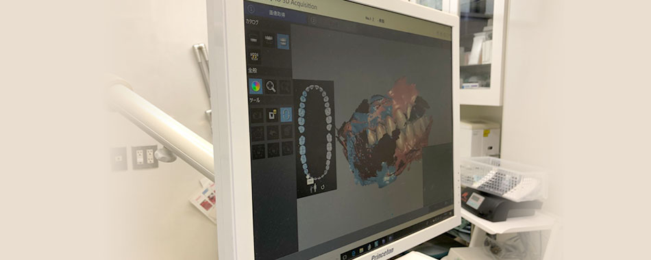 口腔スキャナーによる撮影（口腔内3D光学スキャナー）