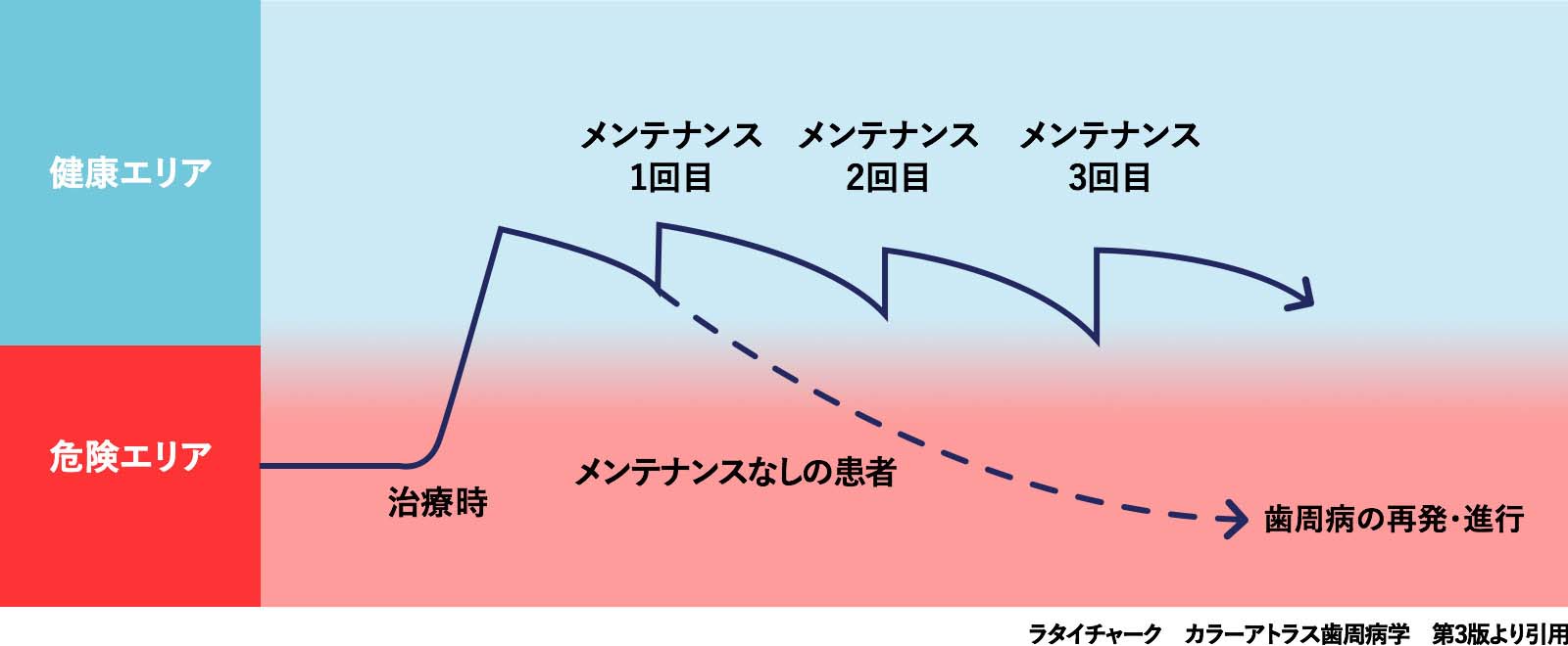 ラタイチャーク　カラーアトラス歯周病学　第3版より引用